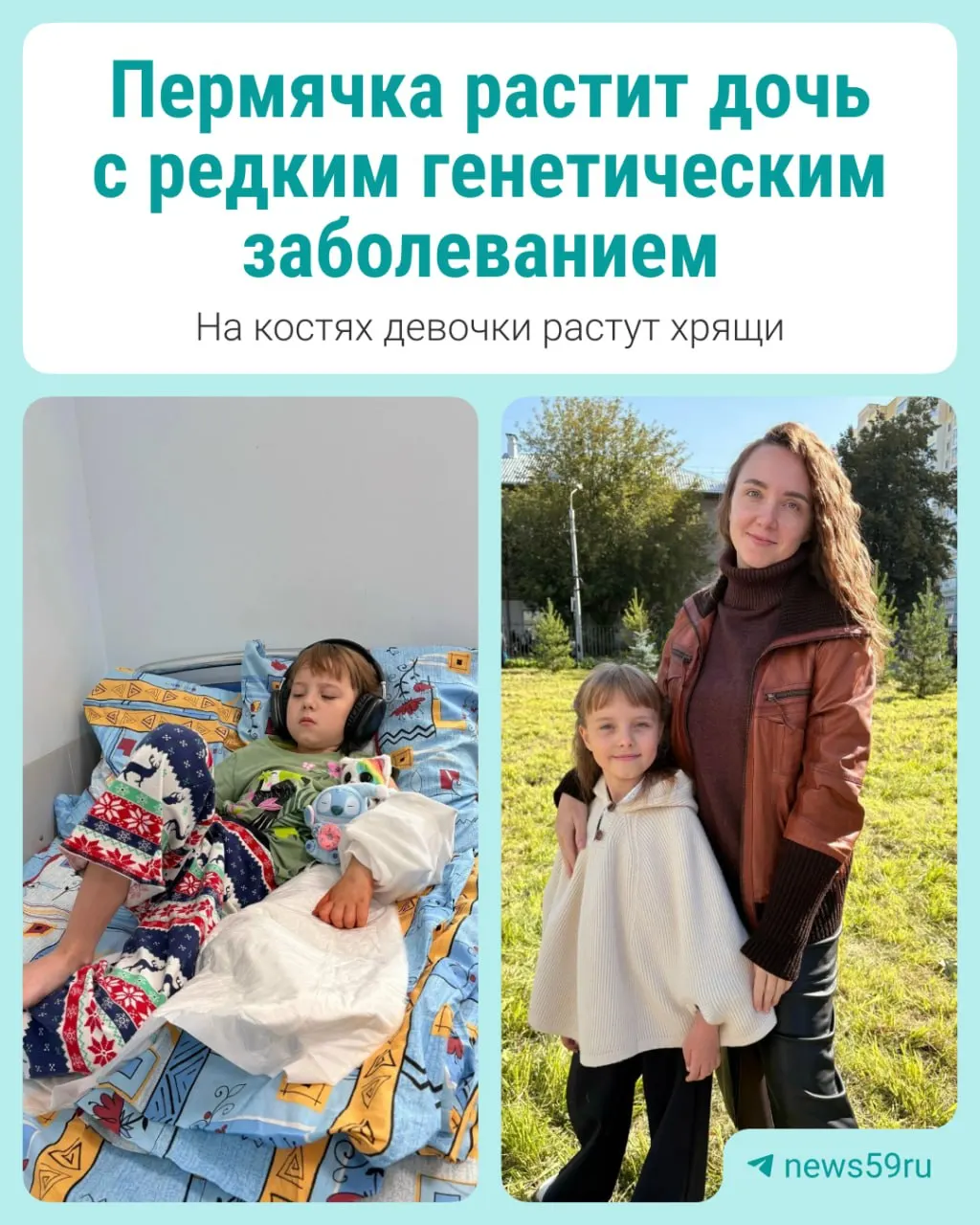 У Софии диагностировали редкое генетическое заболевание — экзостозную хондродисплазию. Родители ищут доступное лечение и поддержку; материал включает разбор ситуации и комментарий регионального Минздрава.