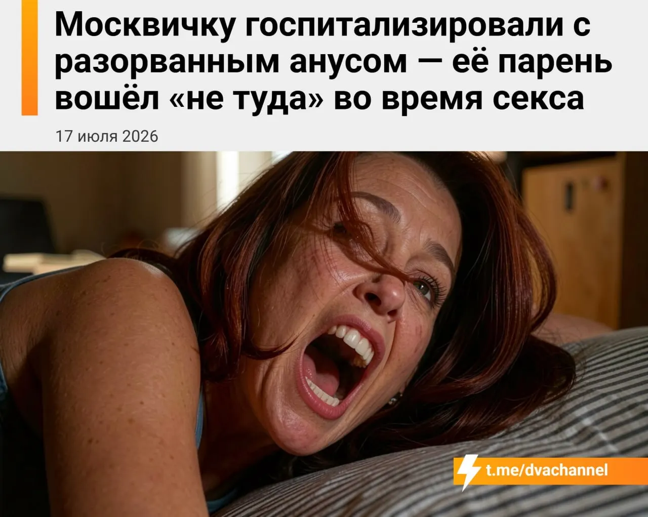 20‑летнюю девушку доставили в больницу с разрывом кишечника и сильным кровотечением после того, как партнёр по ошибке вошёл в задний проход. Ей провели экстренную операцию, дальнейшее восстановление займёт время.