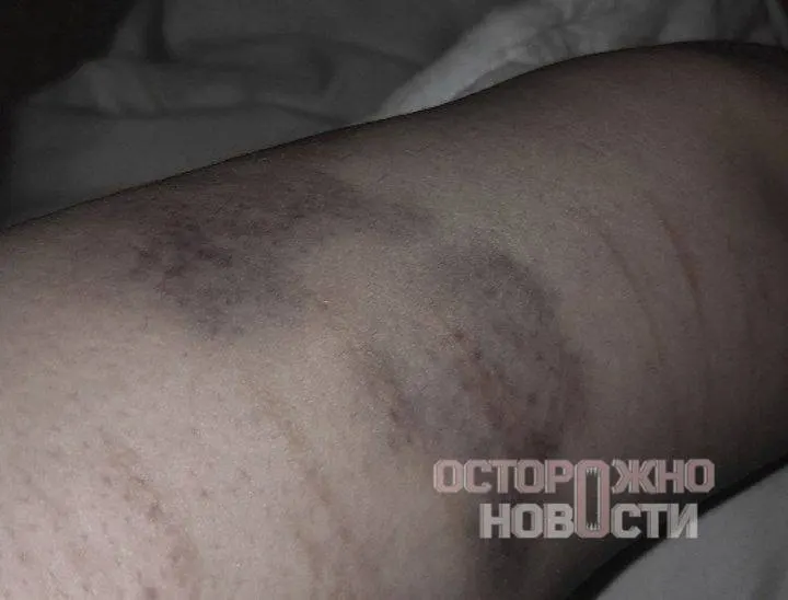 Мужчина, которого вместе со стримером поместили в автозак, утверждает, что сотрудники ОМОНа избивали задержанных, применяли электрошокер и оскорбляли людей; причины задержания остались неясны.